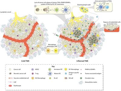 Immune Conversion of Tumor Microenvironment by Oncolytic Viruses: The Protoparvovirus H-1PV Case Study